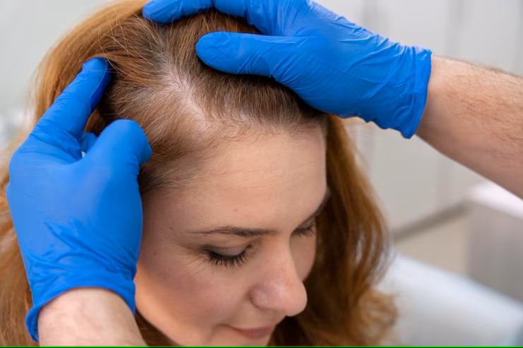 mujer-recibiendo-tratamiento-perdida-cabello